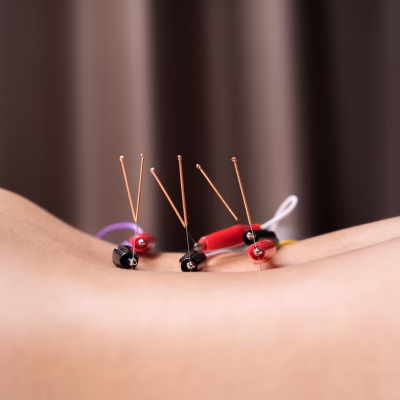 acupunctura