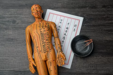 Acupunctură