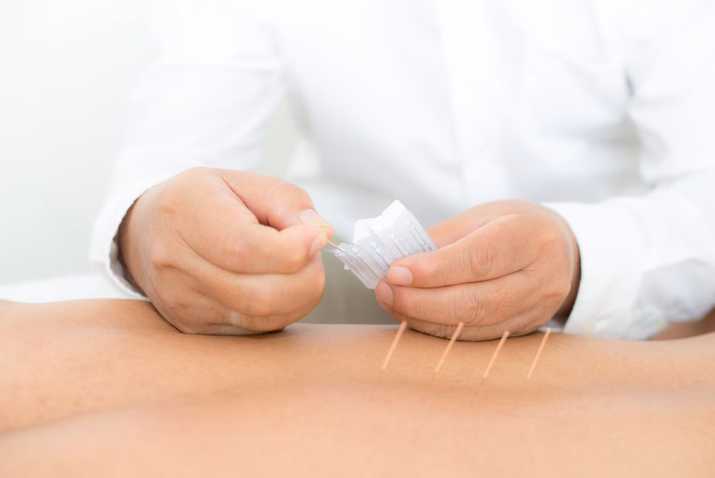 Interviu cu dr. Ștefan Costescu despre acupunctura medicală